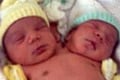 Kesehatan bayi berkepala 2 asal Cilacap terus memburuk