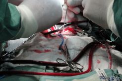 Organ jantung jenazah TKW asal Karawang hilang
