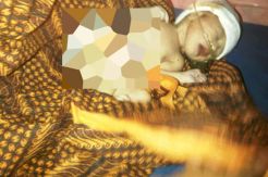 Bayi dengan usus terburai di Serang akhirnya meninggal dunia