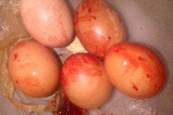Sandra yang Melahirkan 5 Butir Telur Ternyata Seorang Tabib
