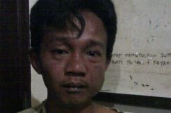 Spesialis Peremas Payudara...