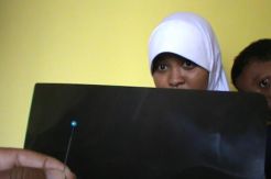 Jarum Pentul Tertelan di Perut Siswi SMP