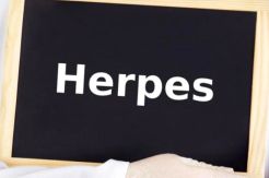 Hindari Nyeri Pasca-Herpes...
