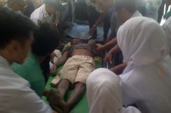 Dua Pekerja Tewas Kekurangan Oksigen Dalam Sumur