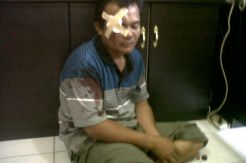 Mau Curi Burung, Pria ini Babak Belur Dihajar Massa