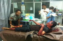 Duel Berdarah, 2 Warga Batam Saling Tikam dengan Pisau