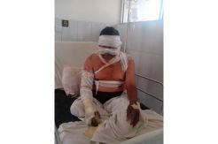 Pria Ini Nyaris Tewas Dibakar Hidup-Hidup