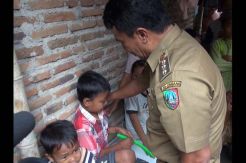 Bupati Jamin Pengobatan Bocah Penyakit Langka