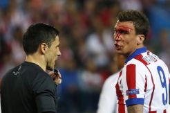 Suarez Kecam Keputusan Wasit Sangat Buruk