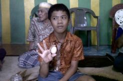 Bertelur 7 Kali, Bocah di Gowa Masih Sakit Perut