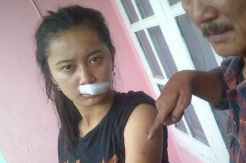 Cemburu, Oknum Polisi Aniaya Teman Wanita hingga Babak Belur
