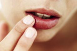 Cara Mengatasi Bibir...