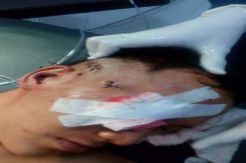 Kereta Api Dilempari Batu, Asisten Masinis Luka Parah