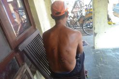 Korban Aksi Bakar Orang di Tegal Trauma