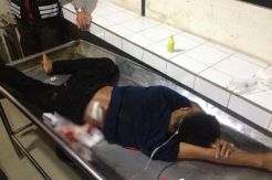 Terlibat Perseteruan Geng ABG, Julio Kena Tikam di Jalan