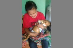 Perut Membesar, Bayi Cantiqa Anindya Butuh Bantuan Dermawan