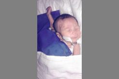 Derita Tumor, Bayi Melisa Meninggal Dunia