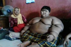 Waw, Bocah 10 Tahun di Karawang Ini Beratnya Capai 192 Kg