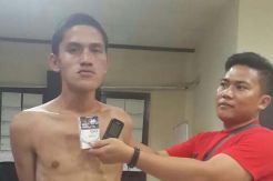 Gara-gara Bekas Panu di Wajah, Pemuda Ini Masuk Penjara