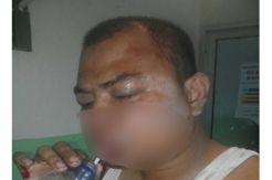 Balas Dendam, Oknum Raider Keroyok Anggota Polri Ini
