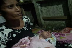 Tolong, Bayi Tanpa Tempurung Kepala asal Pandeglang Butuh Bantuan