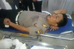 Tangkap Perampok, Polisi Malah Kena Bacok