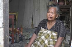 Perut Nenek Nurbaya Membengkak sejak 2002
