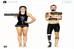 Vogue Brazil Amputated Models in 2106 Rio Paralympics Campaign