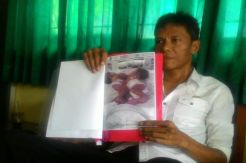 Prihatin Nasib Bayi Kembar Siam, Ketua RT Ini Galang Dana