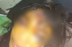 Kasus Suami Kapak Istri Jadi Atensi Khusus Polisi