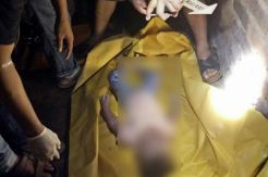Tim Forensik Temukan Luka di Tubuh Balita yang Tewas Dalam Sumur