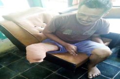 Warga Miskin di Pangandaran ini Butuh Bantuan Kaki Palsu