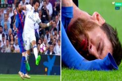 Video Messi Muntah Darah Disikut, Barcelona Menangi El Clasico