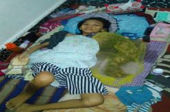 Pemkab Simalungun Bantu Pengobatan Gadis Penderita Tumor Ganas