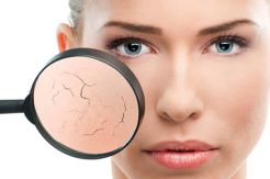 Tips Membuat Serum Alami untuk Atasi Kulit Kering