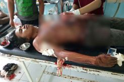 Kapten Kapal Saling Tikam dengan Juru Masak