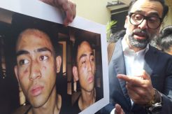 Hasil Tes Urine Anak Jeremy Thomas Negatif