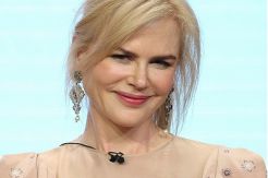 Nicole Kidman Trauma Jalani Perawatan Botox
