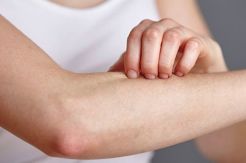Penyakit Kulit Psoriasis Serang Fisik dan Mental
