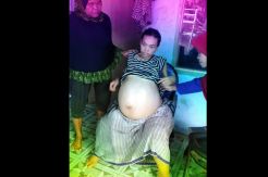 Hasil Kerja 10 Tahun TKW Ini Ludes untuk Mengobati Penyakit Aneh