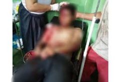 Main Bacok Seenaknya, DA Dicokok saat Asyik Istirahat