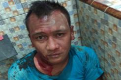 Rampas Tas Mahasiswi, Penjambret Babak Belur Dihajar Warga