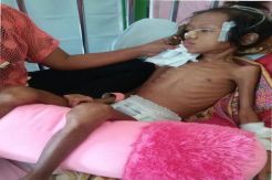 Satu Lagi Bocah Gizi Buruk Akut Dirawat di RSUD Sultan Imanuddin