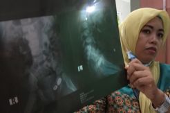 Balita 16 Bulan Terkena Peluru Nyasar