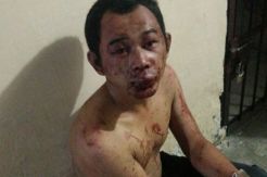 Gagal Curi Motor, Warga Medan Nyaris Tewas Dimassa