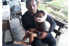 Ayah dan Ibunya Dibantai, Bocah 6 Tahun Ini Juga Dianiaya Tentara OPM