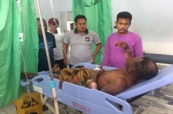 Speed Boat Milik Setda Raja Ampat Meledak, 2 Crew Luka Bakar Serius