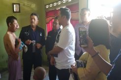 Penderita Tumor Wajah Warga Deliserdang Jalani Pengobatan