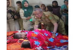 Dua Anak Ini Menderita Hidrosefalus Sejak Kecil