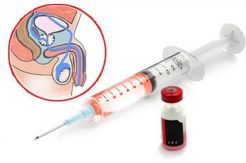 Kazakhstan Kebiri 2.000...